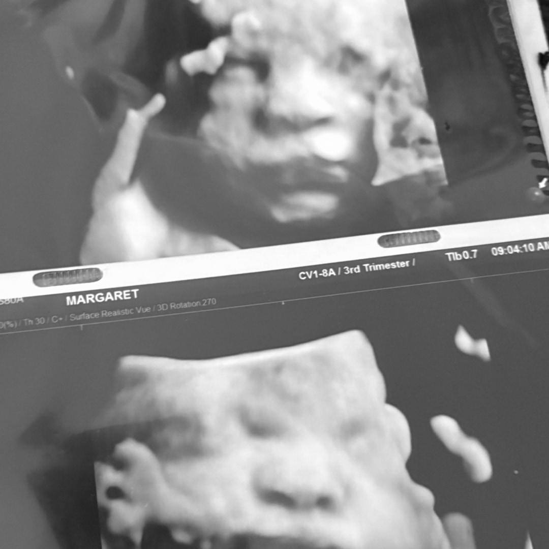 Photo shared by Margaret for their Babylist baby registry.