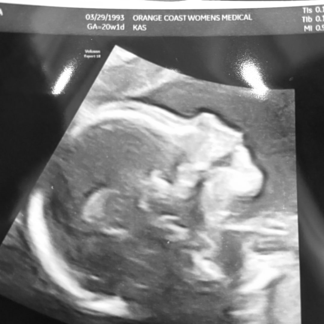 Photo shared by Micaela for their Babylist baby registry.