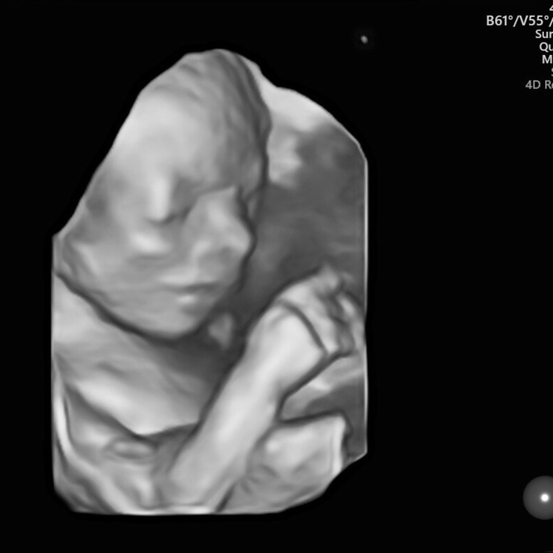 Photo shared by Rachel for their Babylist baby registry.