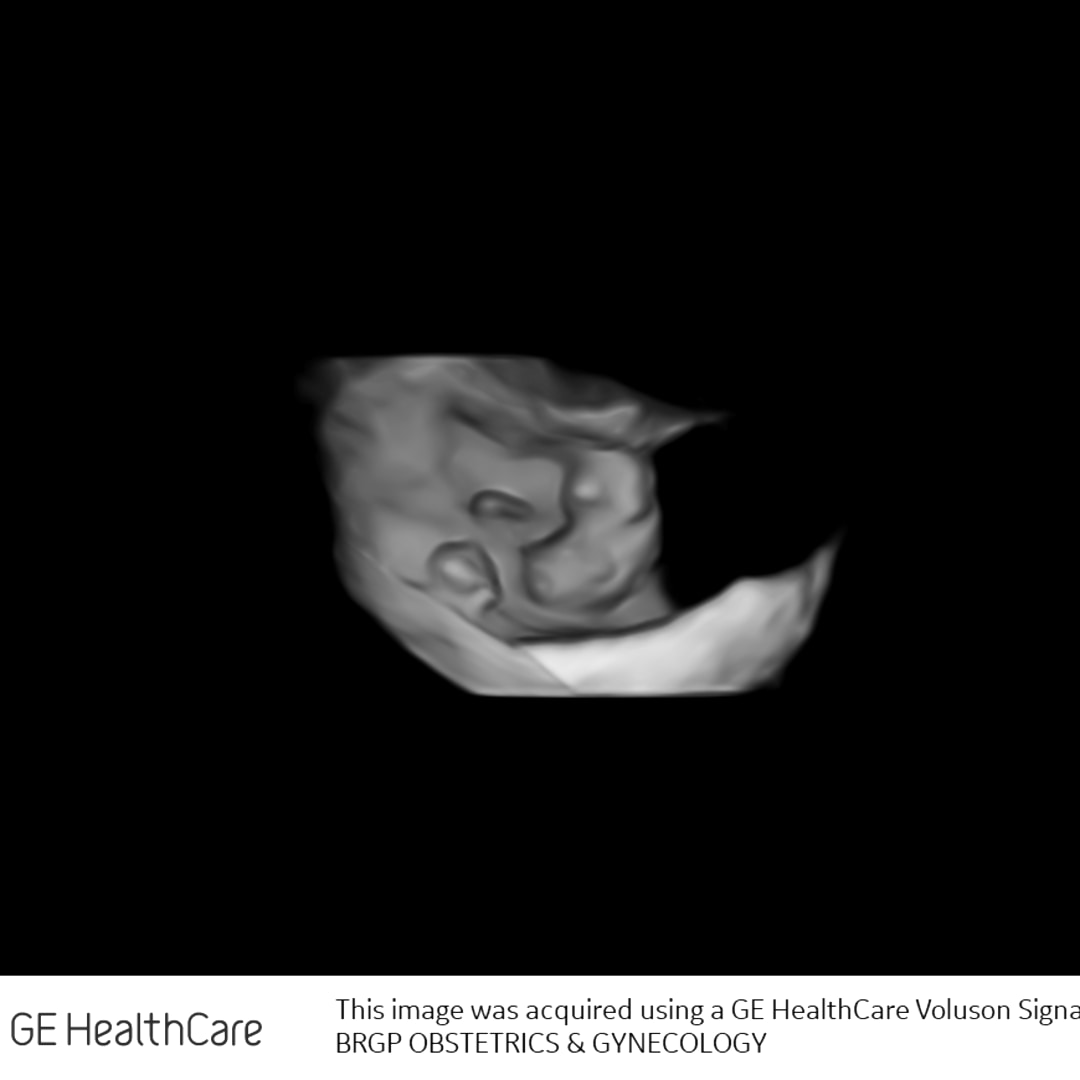 Photo shared by Alaina for their Babylist baby registry.