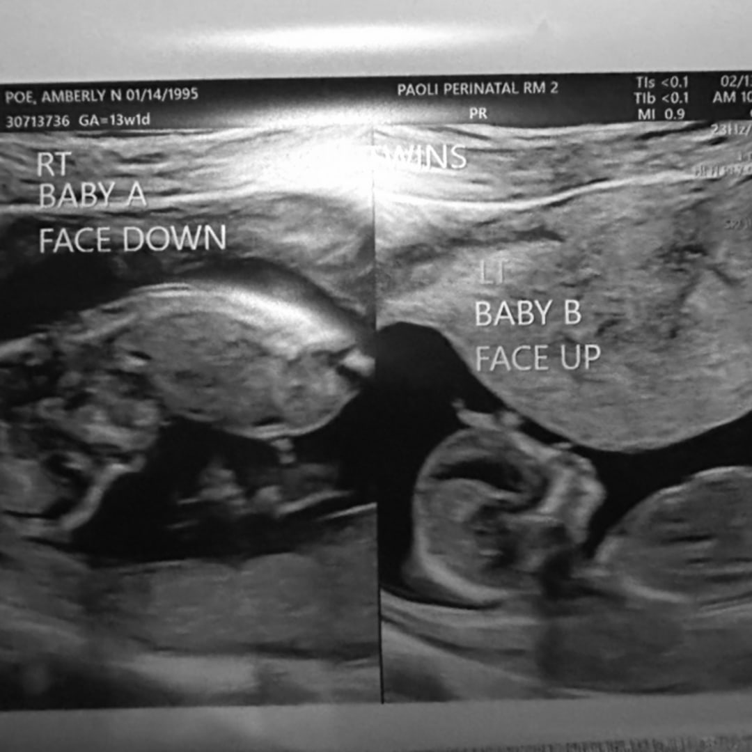 Photo shared by Amberly for their Babylist baby registry.