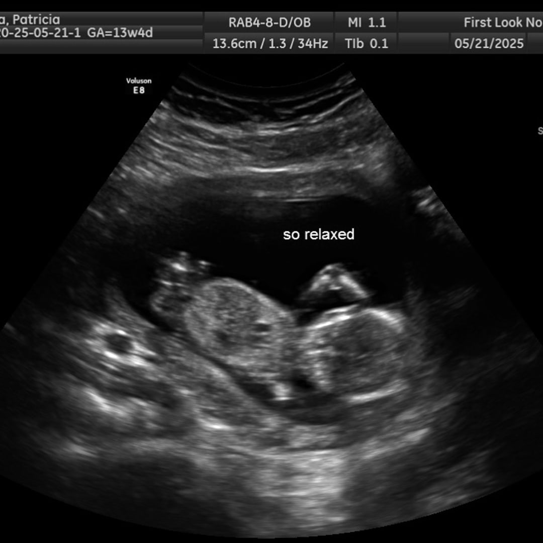 Photo shared by Patricia for their Babylist baby registry.