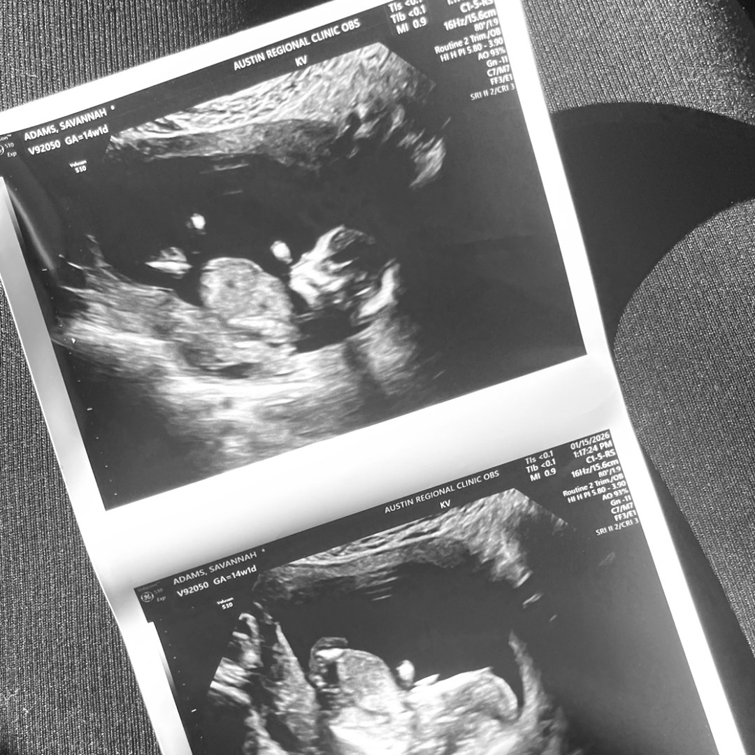 Photo shared by Savannah for their Babylist baby registry.