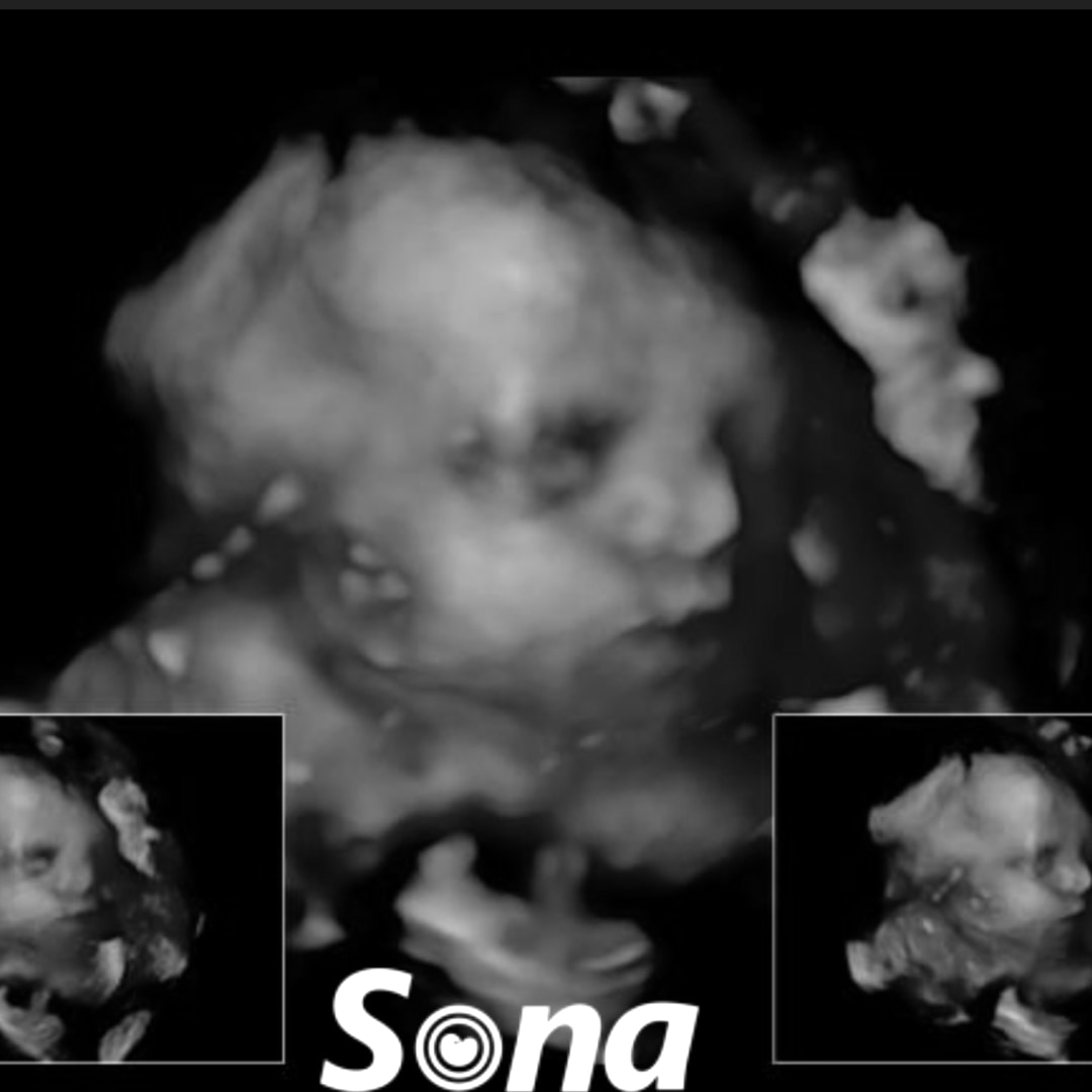 Photo shared by Ashley for their Babylist baby registry.