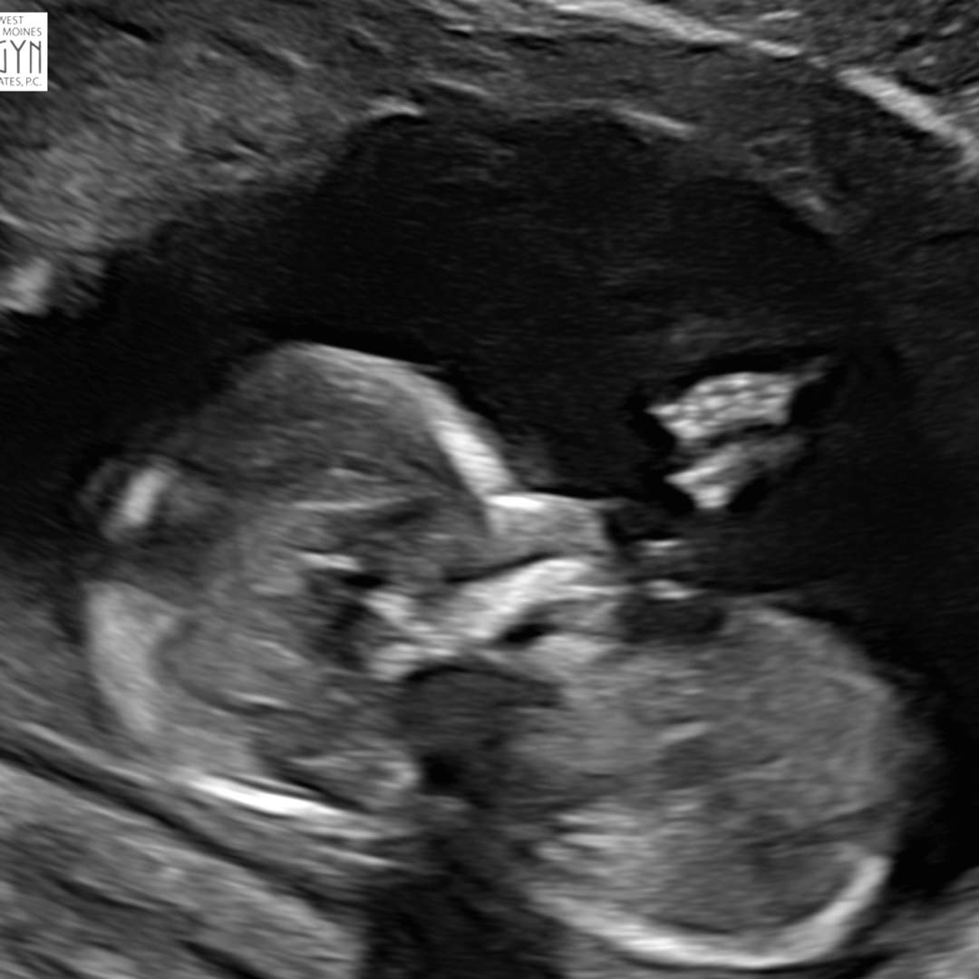 Photo shared by Stefanie for their Babylist baby registry.