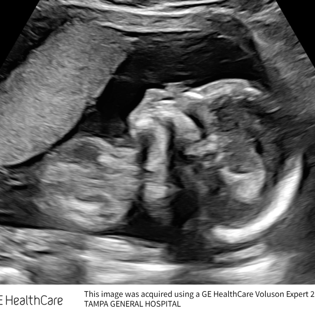 Photo shared by Clarise for their Babylist baby registry.