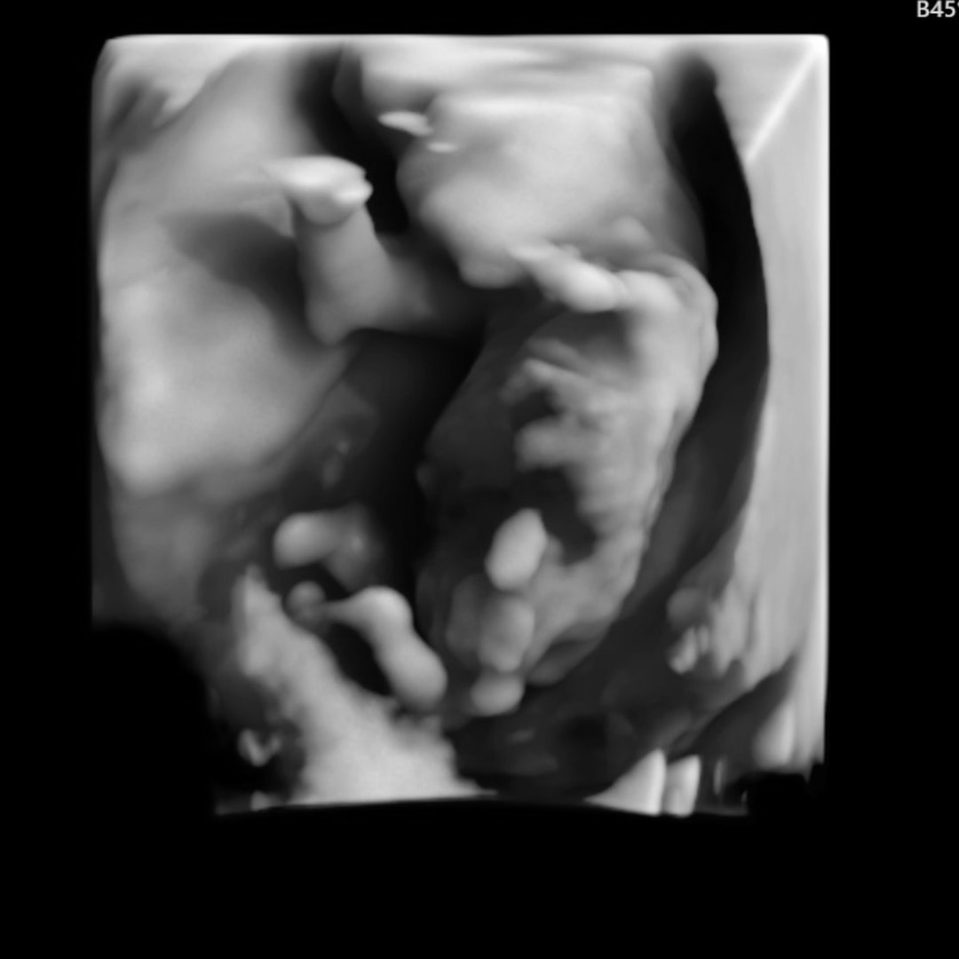 Photo shared by Caitlyn for their Babylist baby registry.