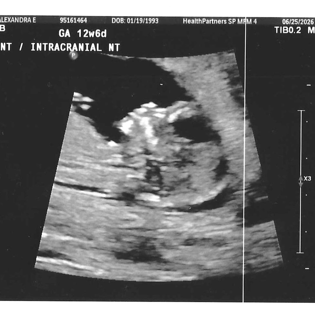 Photo shared by Geoff for their Babylist baby registry.