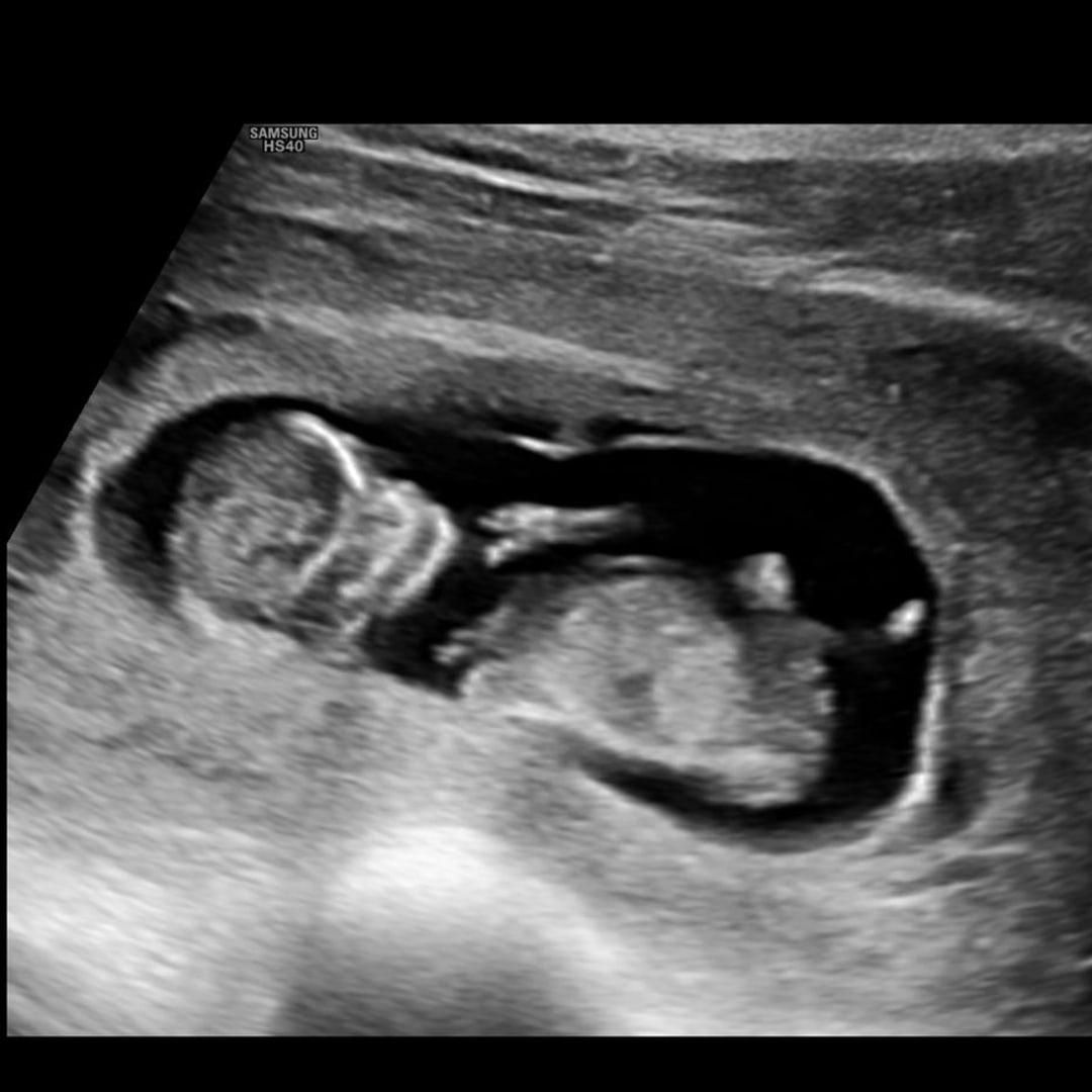 Photo shared by Haley for their Babylist baby registry.