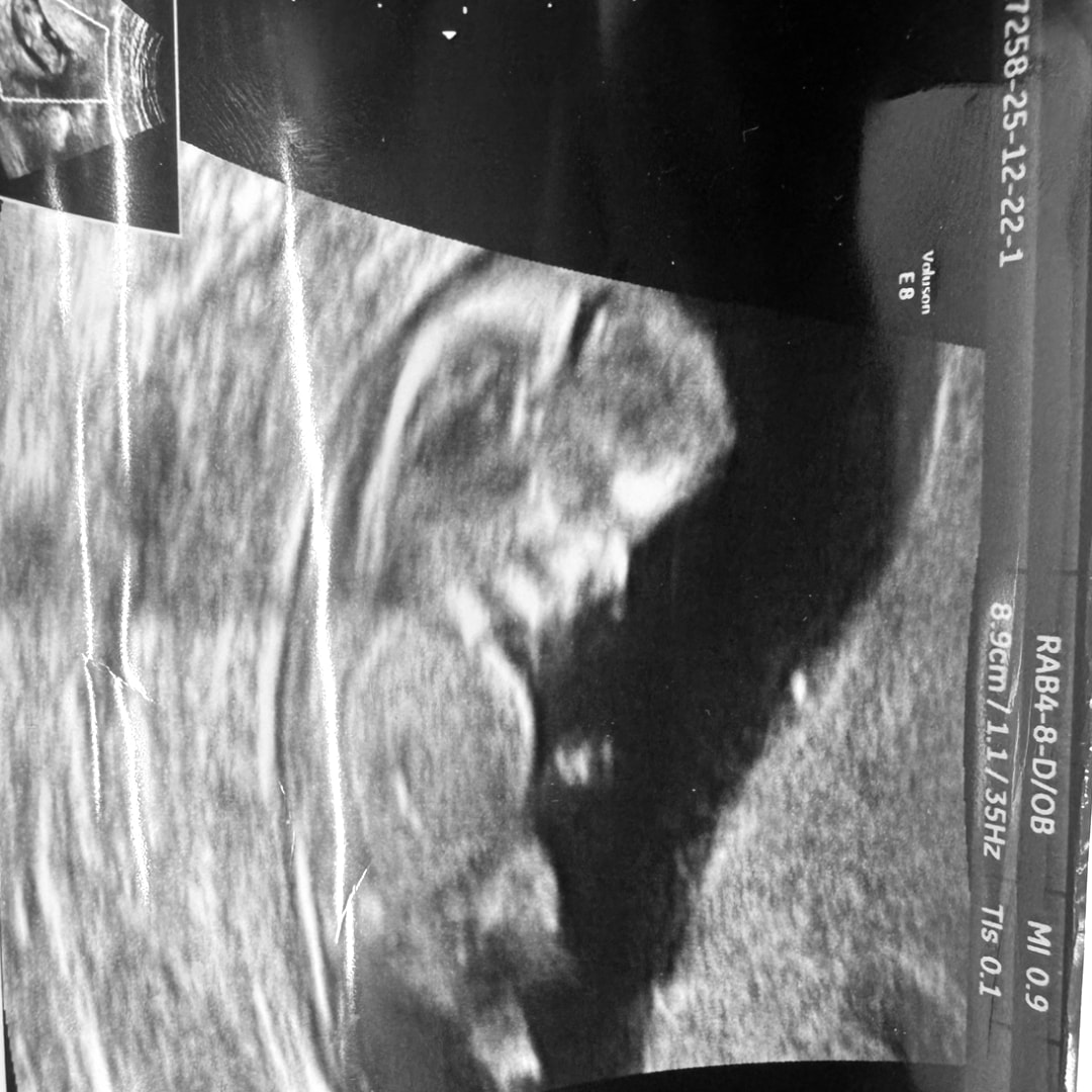 Photo shared by Grace for their Babylist baby registry.