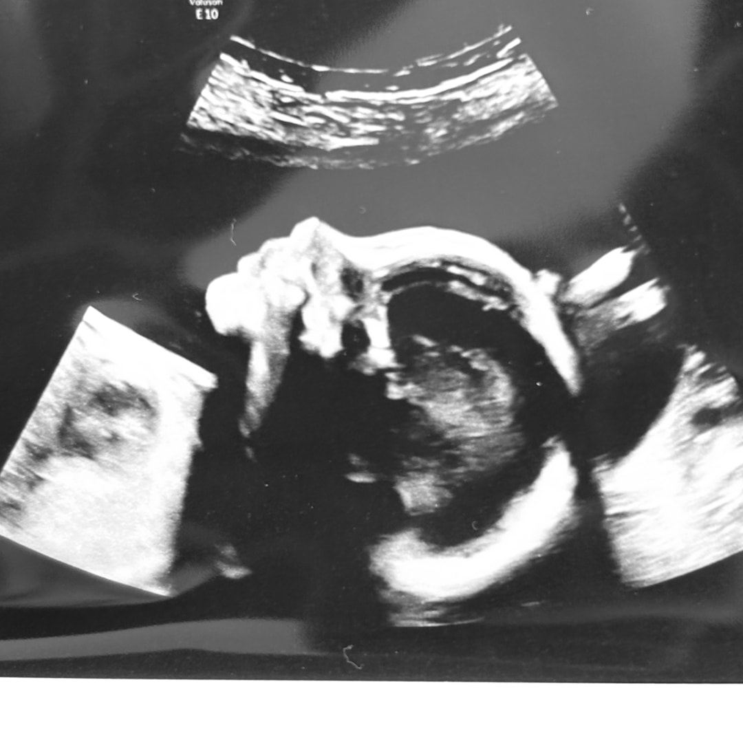 Photo shared by Brooke for their Babylist baby registry.