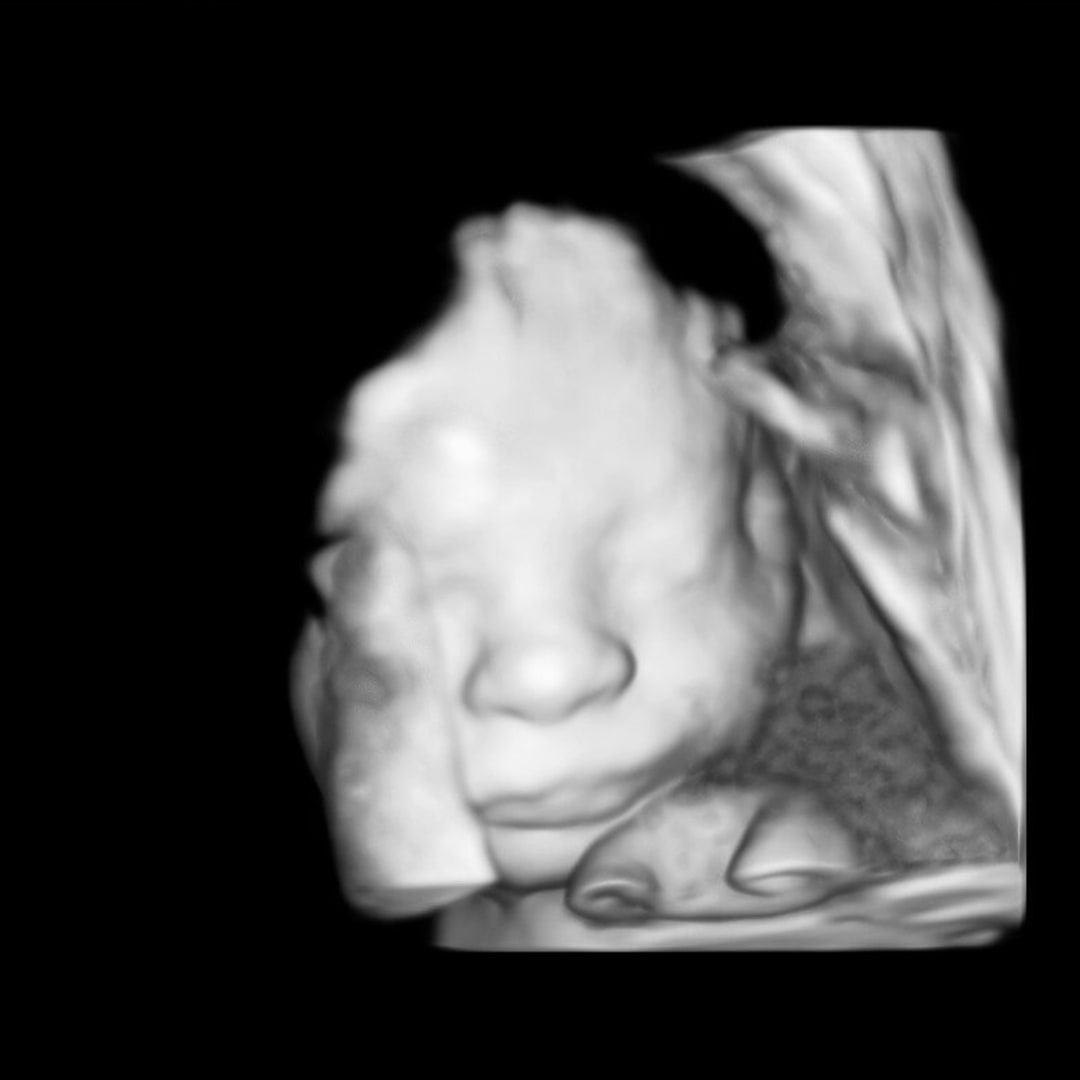 Photo shared by Ashley for their Babylist baby registry.