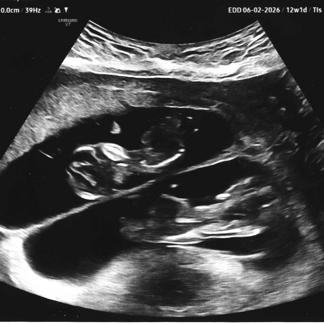 Photo shared by Tia for their Babylist baby registry.