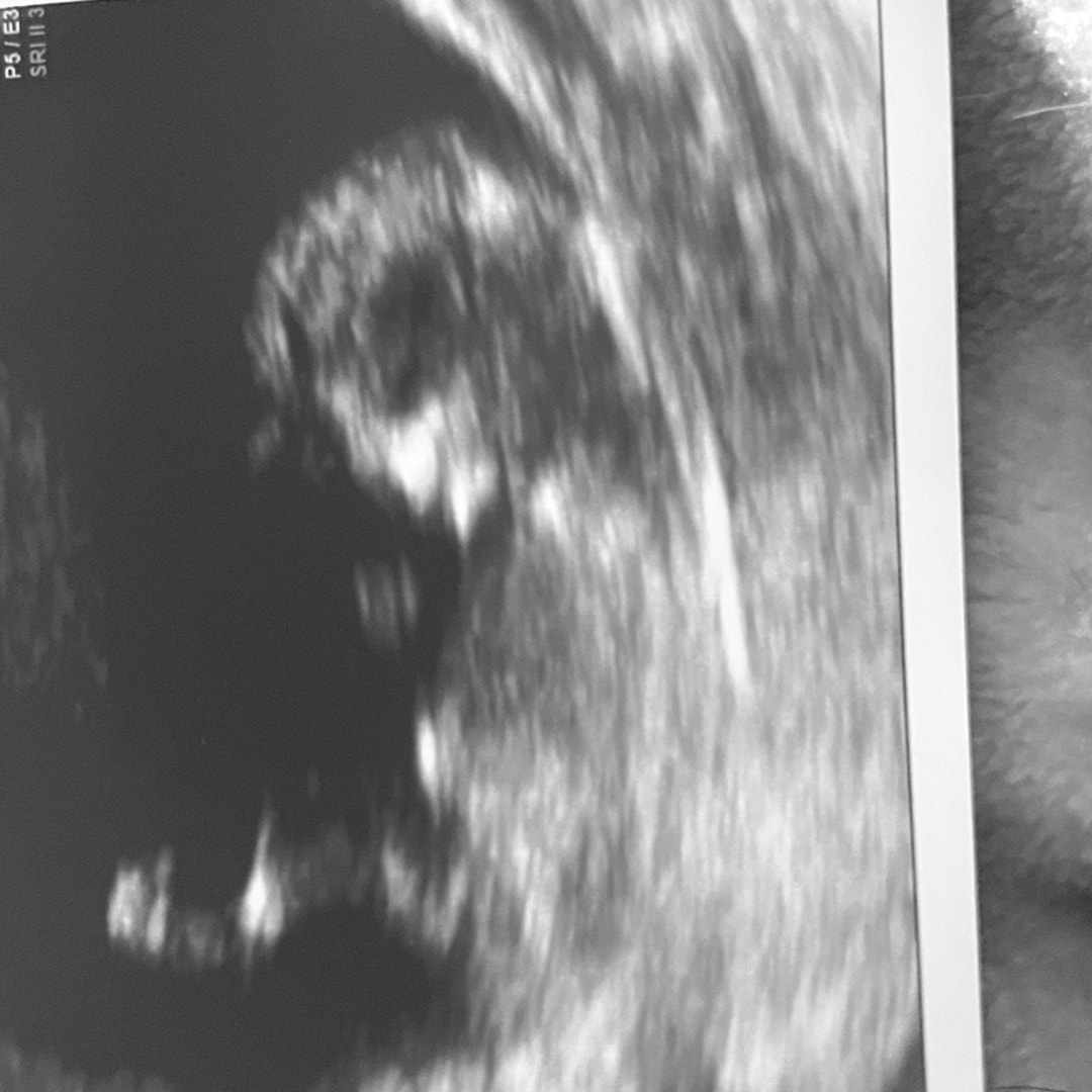 Photo shared by Cate for their Babylist baby registry.