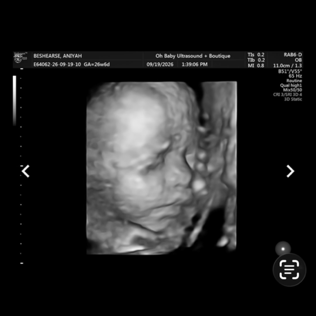 Photo shared by Aniyah for their Babylist baby registry.