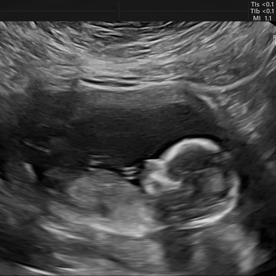 Photo shared by Kristina for their Babylist baby registry.