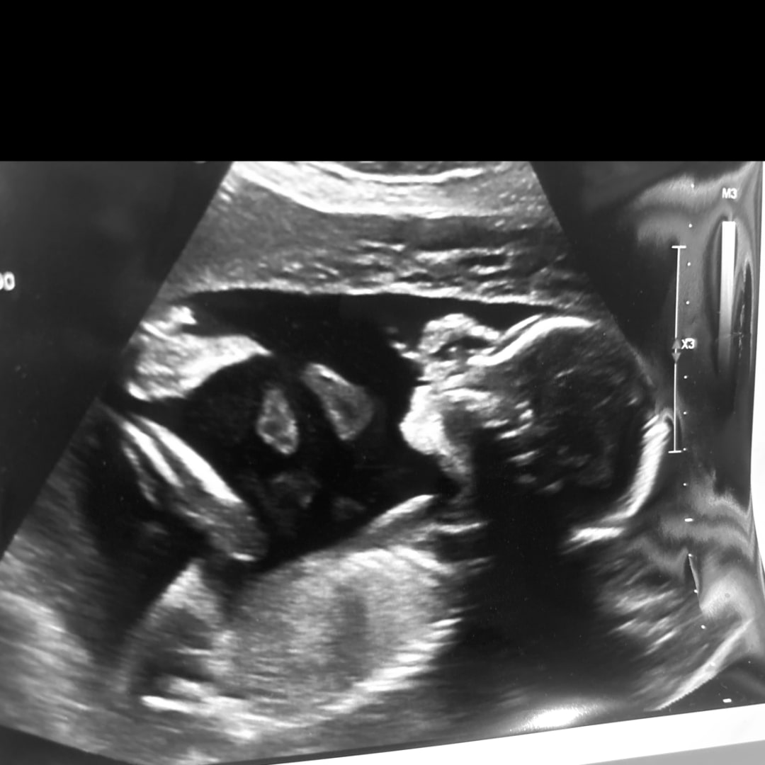 Photo shared by Jamari for their Babylist baby registry.