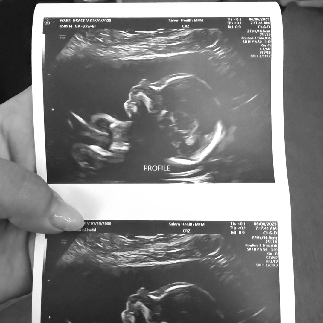 Photo shared by Gracie for their Babylist baby registry.