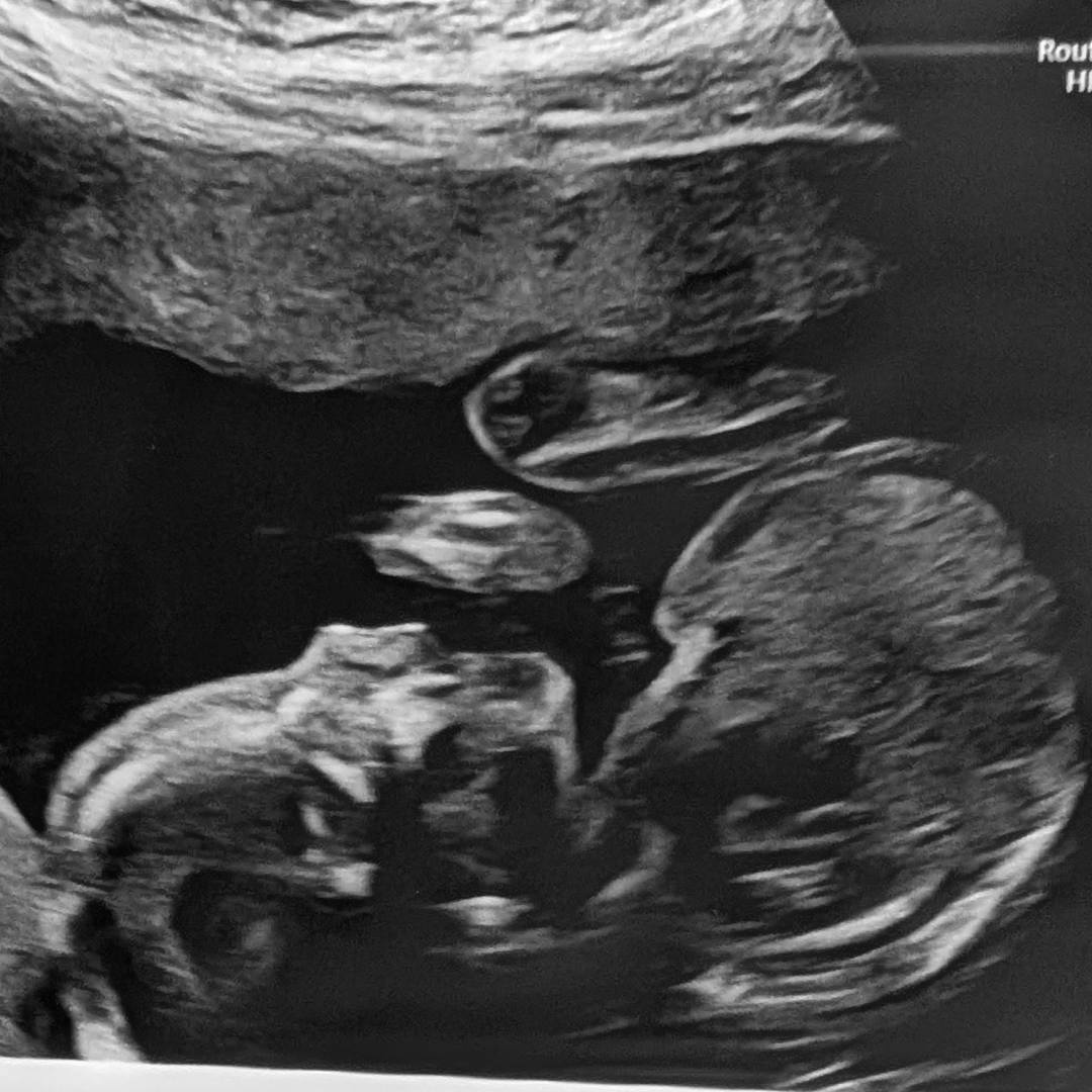 Photo shared by Kaia for their Babylist baby registry.