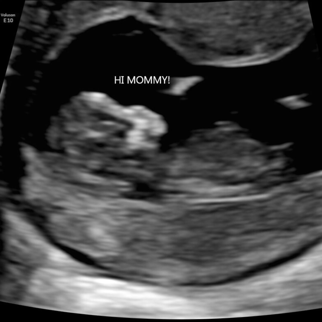 Photo shared by Madison for their Babylist baby registry.