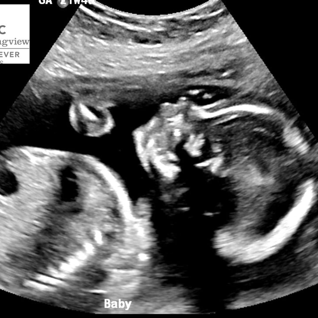 Photo shared by Viridiana for their Babylist baby registry.