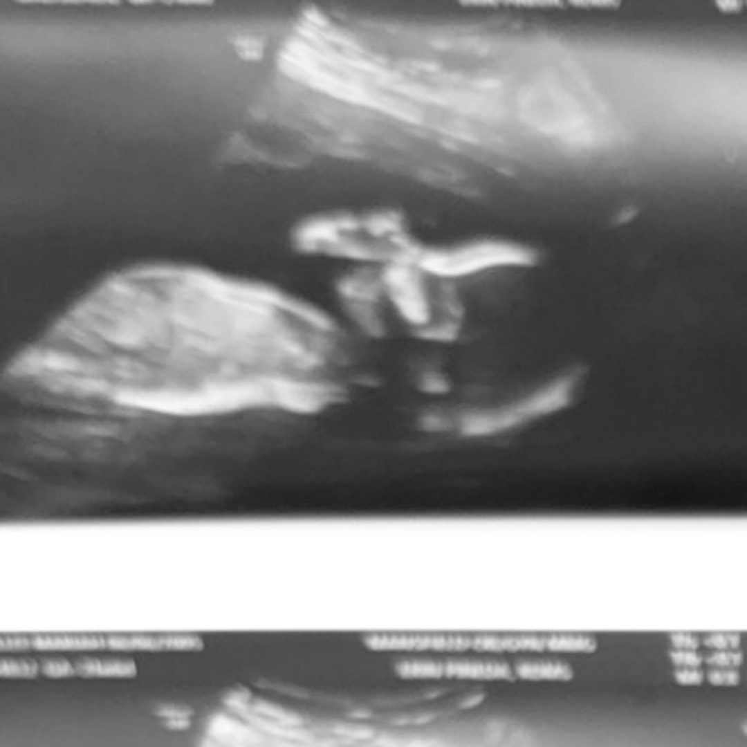 Photo shared by Alize’ for their Babylist baby registry.