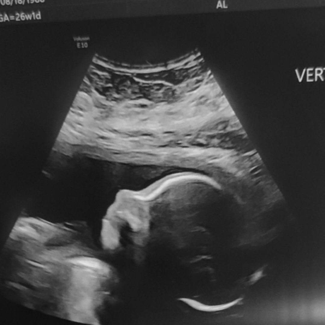 Photo shared by Beatriz for their Babylist baby registry.