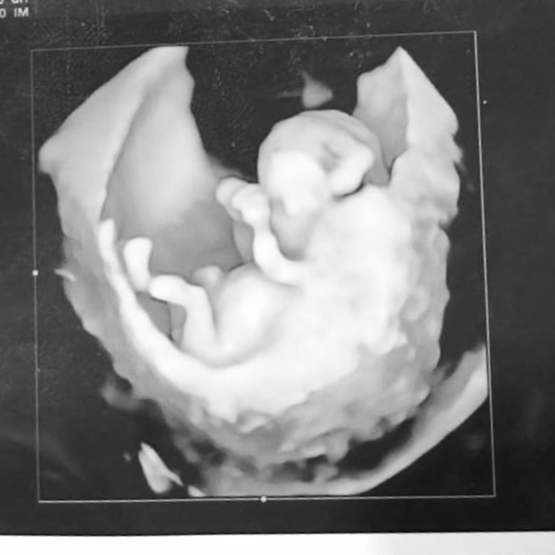 Photo shared by Angie for their Babylist baby registry.