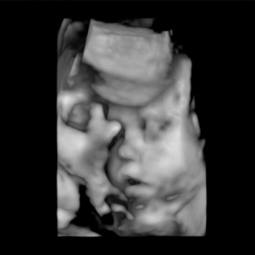 Photo shared by Laura for their Babylist baby registry.