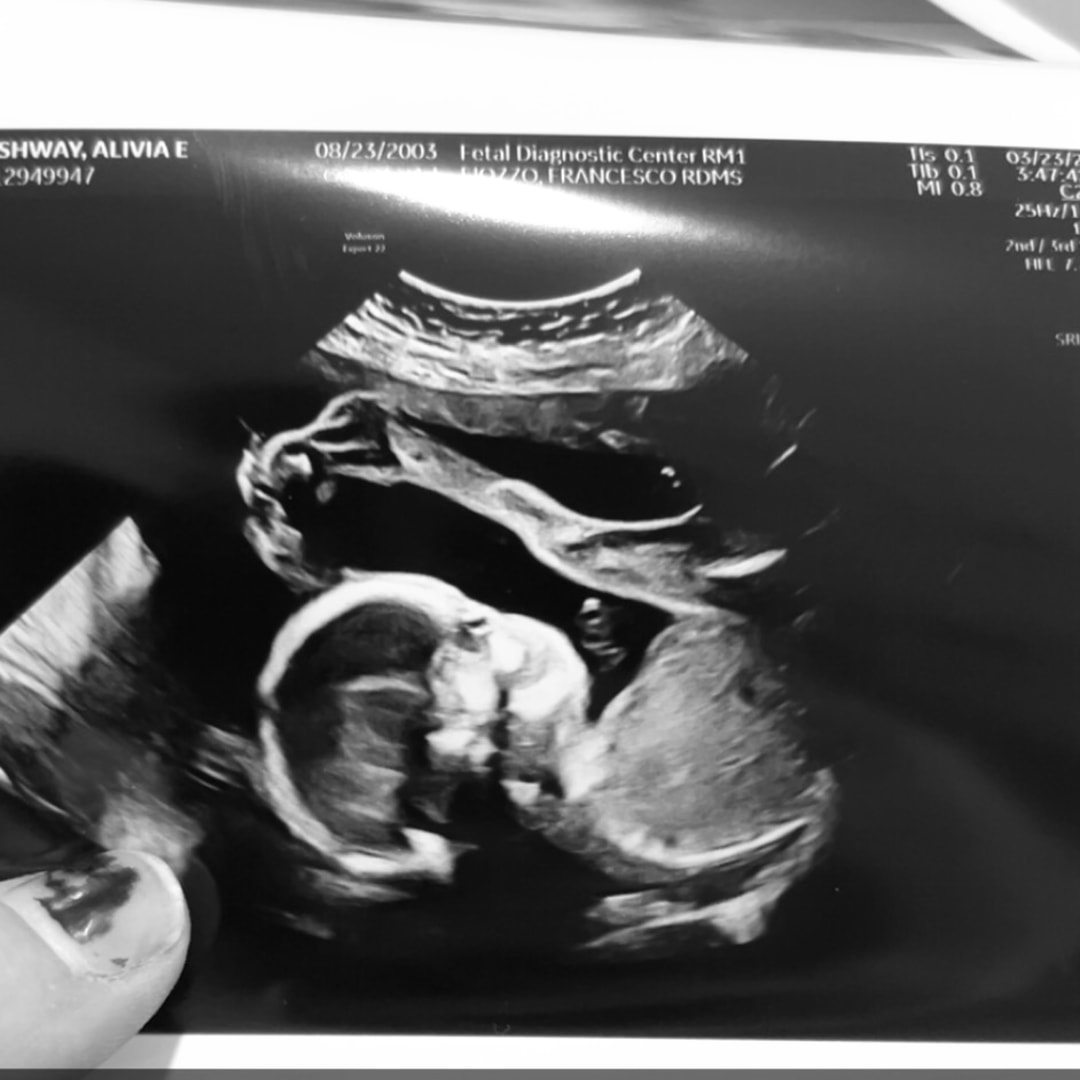 Photo shared by Alivia for their Babylist baby registry.