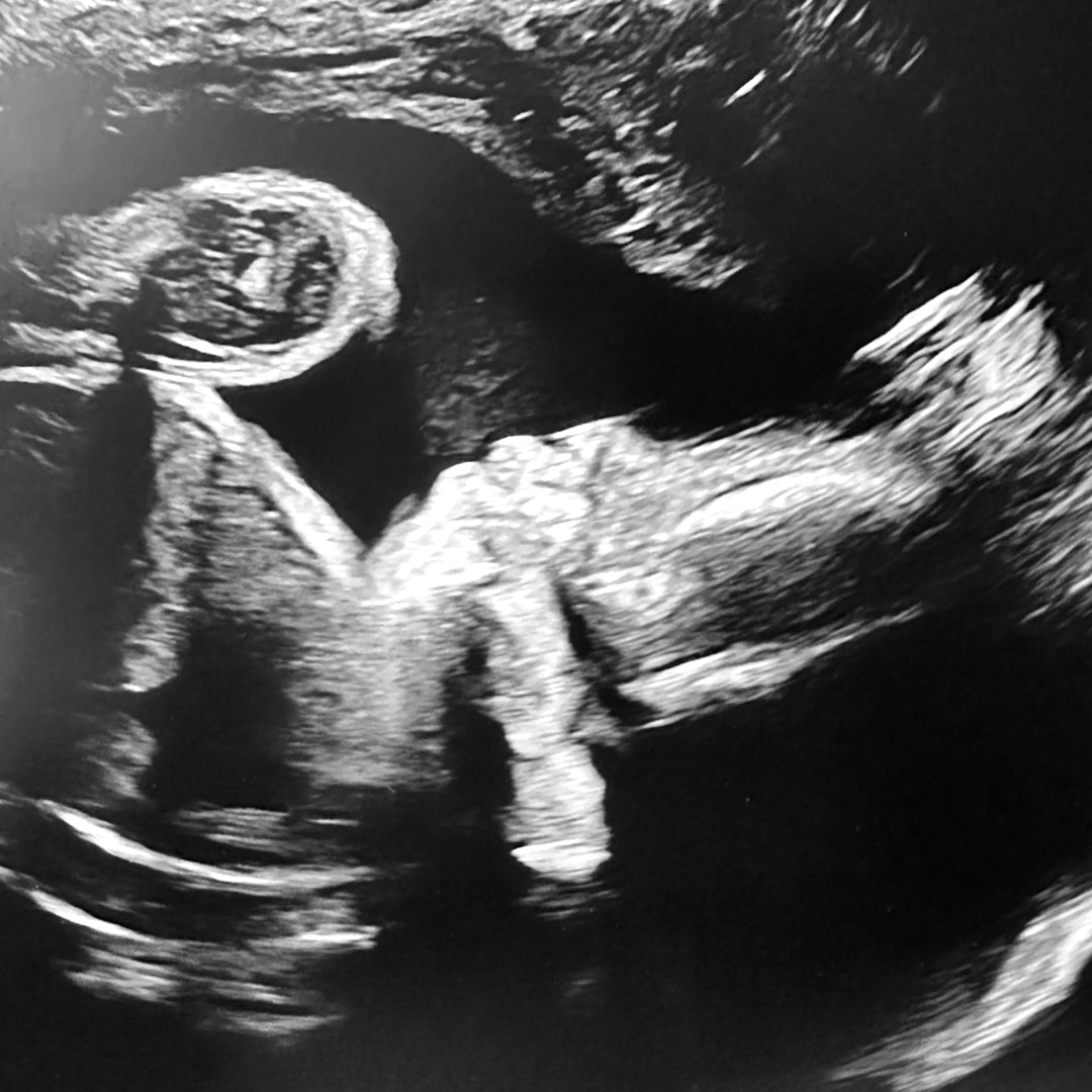 Photo shared by Ali for their Babylist baby registry.