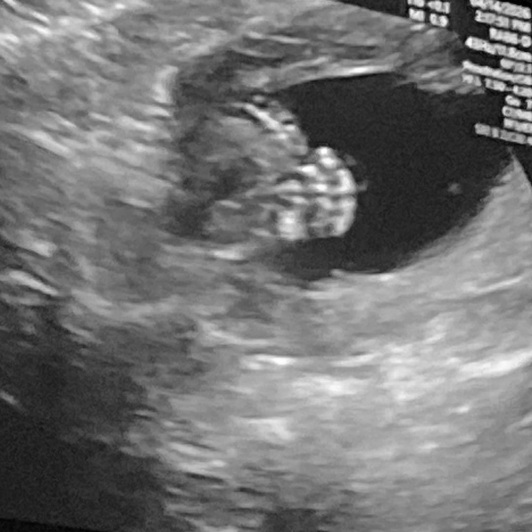 Photo shared by Elizabella for their Babylist baby registry.