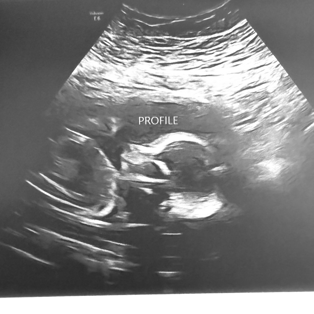 Photo shared by Cortny for their Babylist baby registry.