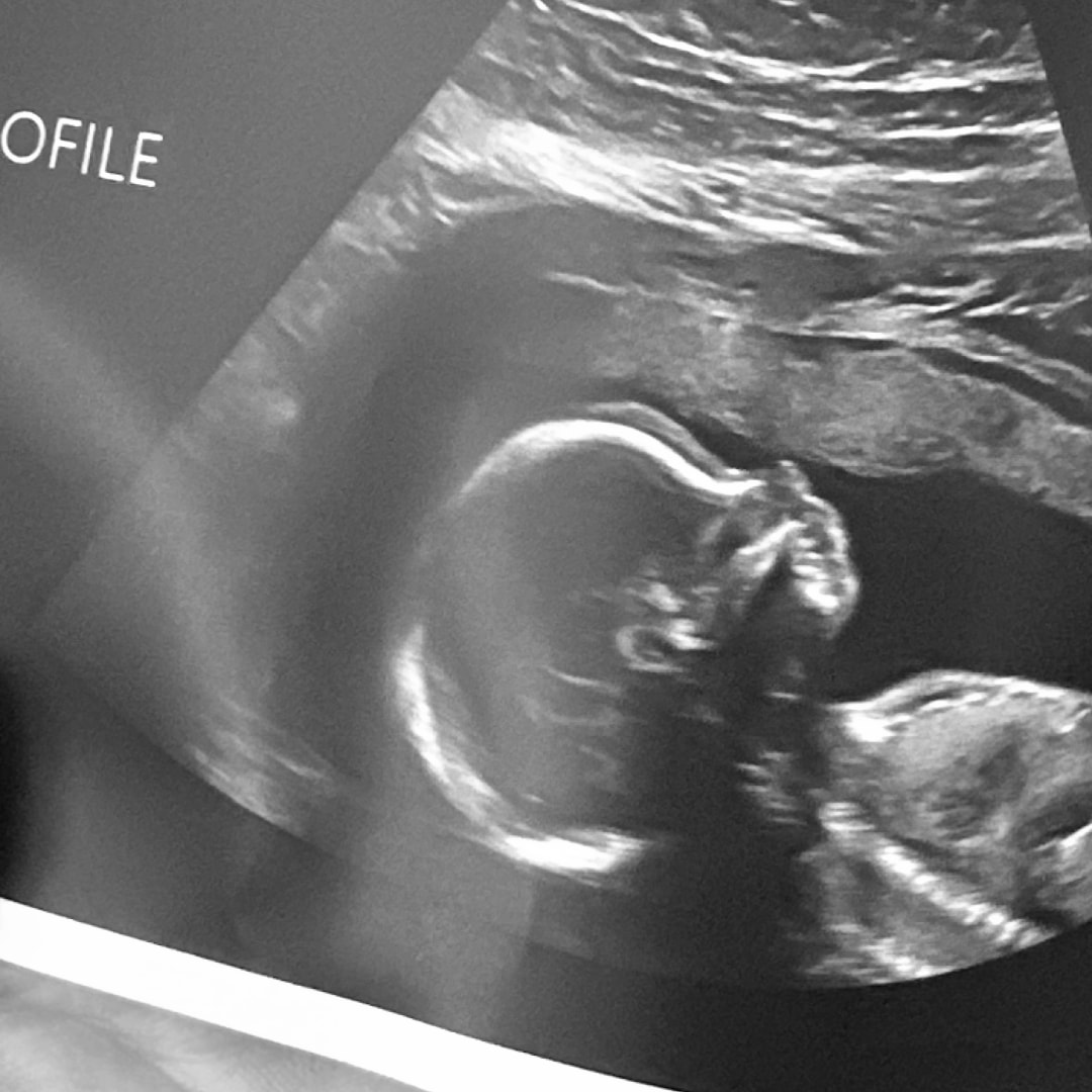 Photo shared by Brittany for their Babylist baby registry.