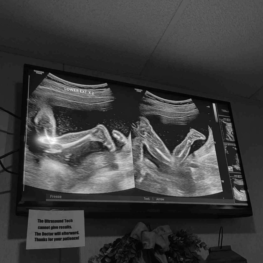 Photo shared by Alli for their Babylist baby registry.