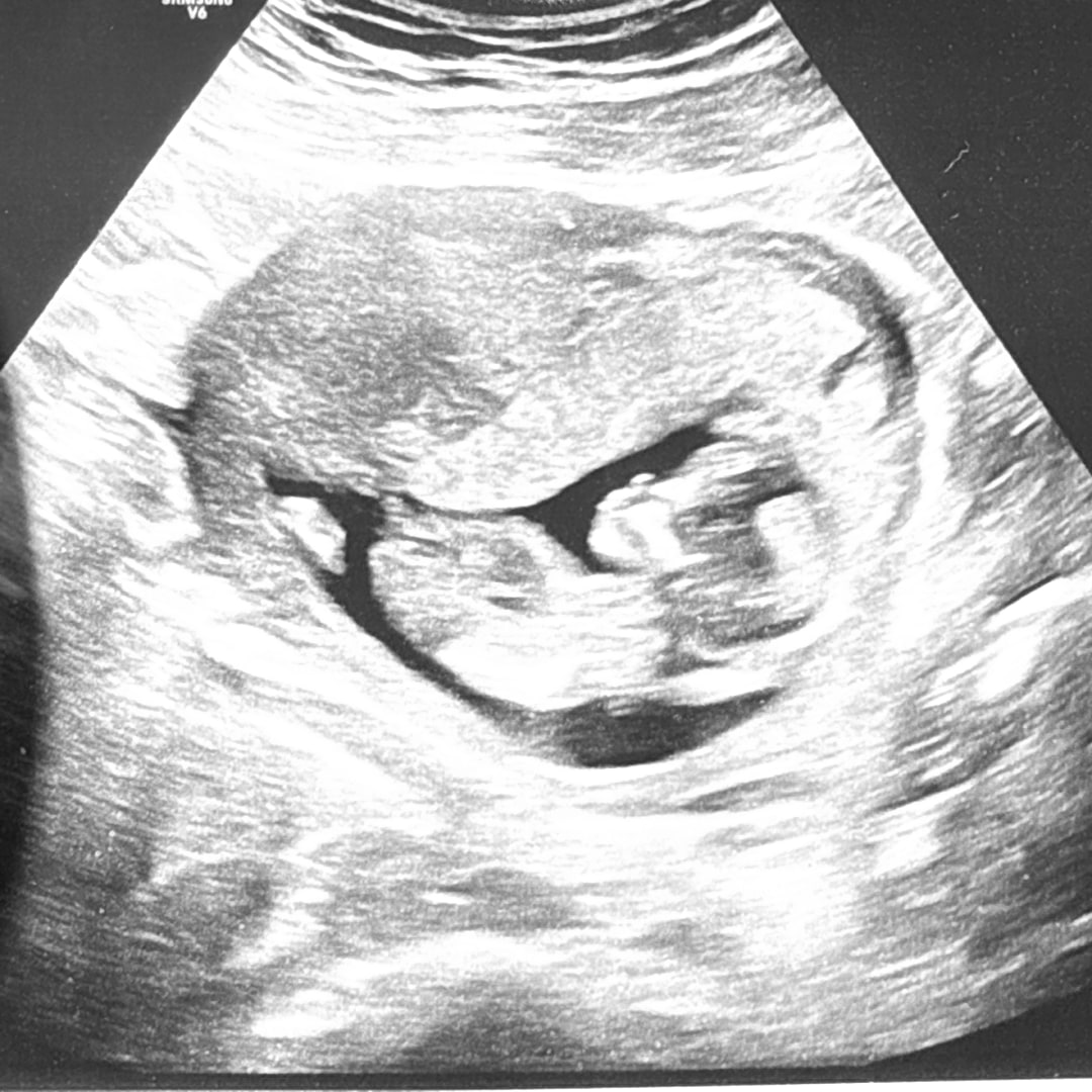 Photo shared by Machanna for their Babylist baby registry.