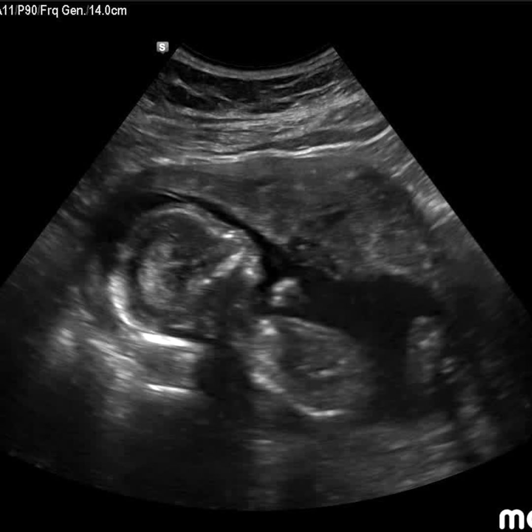 Photo shared by Marrisa for their Babylist baby registry.