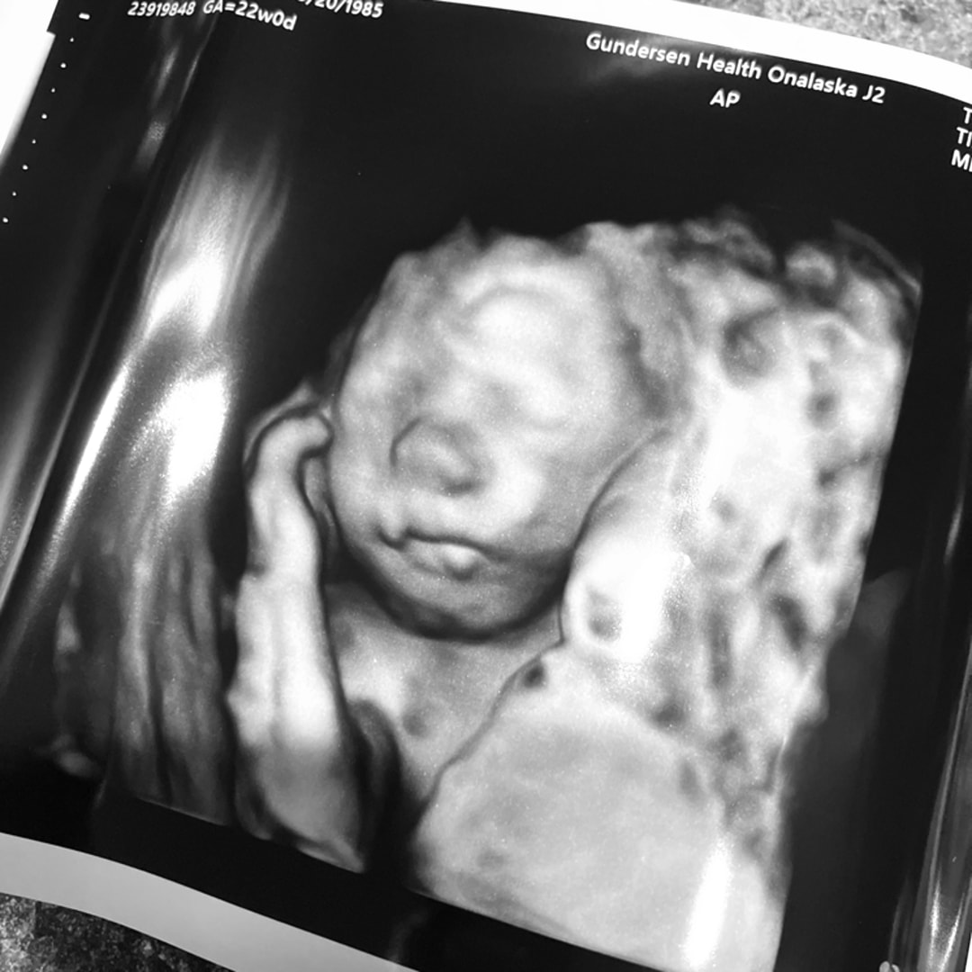 Photo shared by Joanna for their Babylist baby registry.