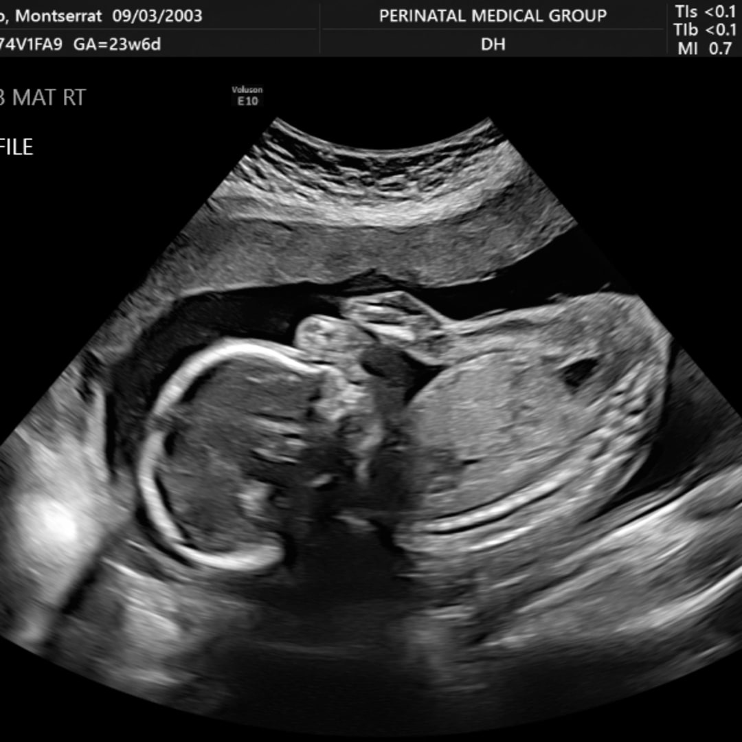Photo shared by Montserrat for their Babylist baby registry.