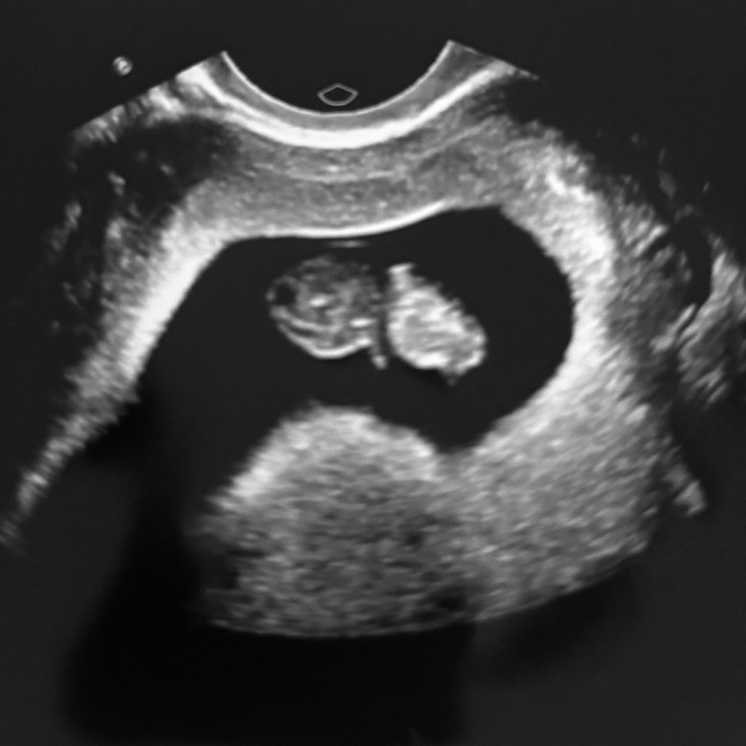 Photo shared by Brianna for their Babylist baby registry.