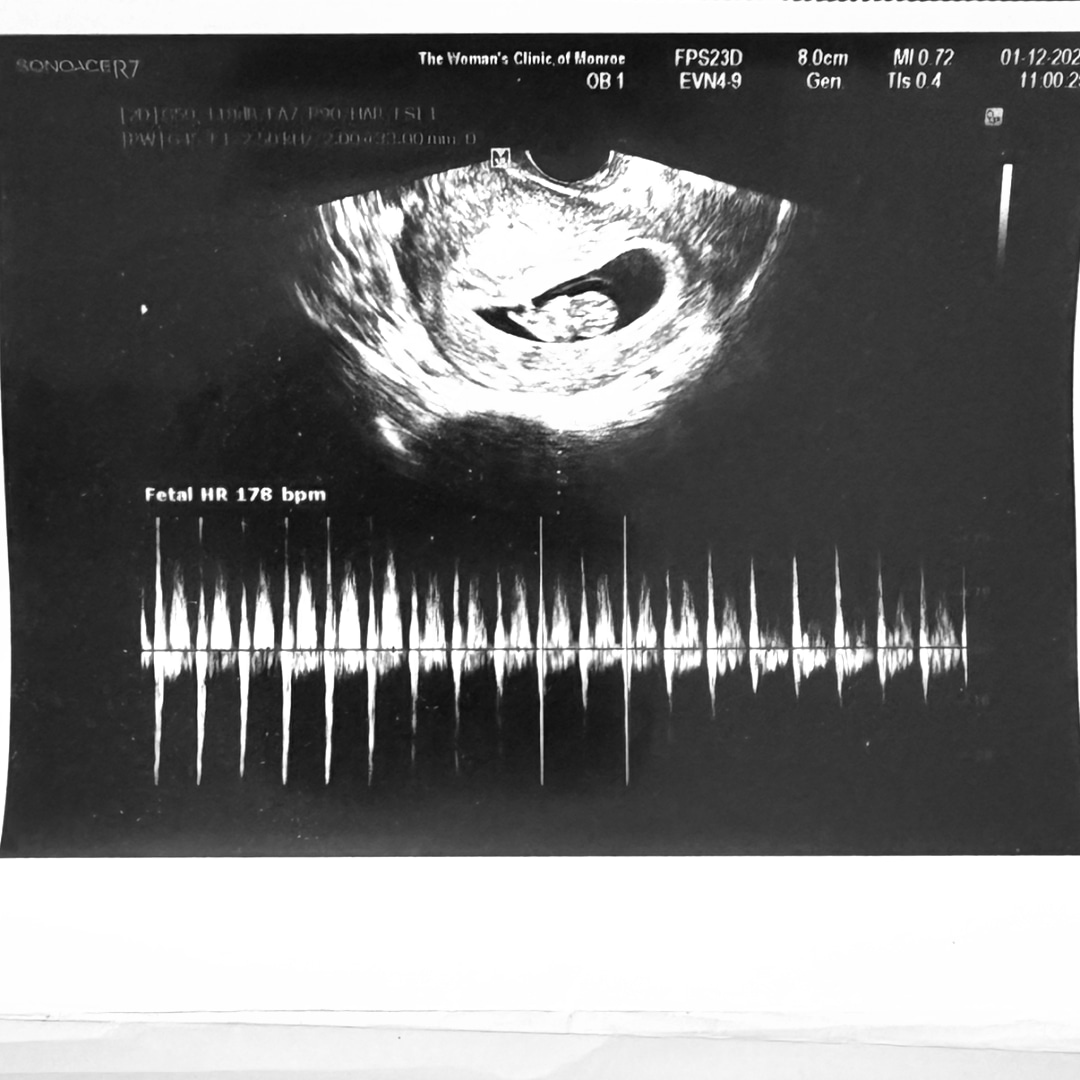 Photo shared by Adrianna for their Babylist baby registry.