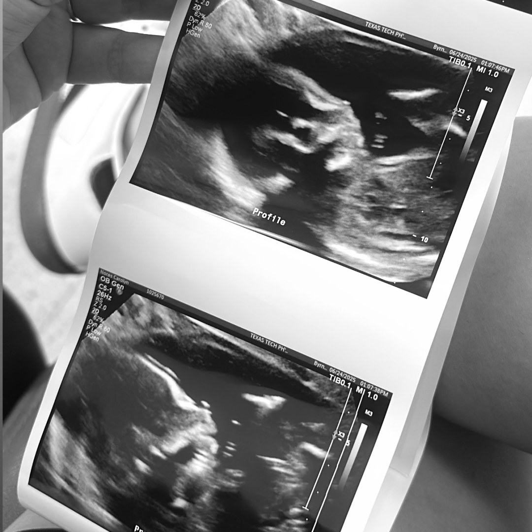 Photo shared by Carolyn for their Babylist baby registry.