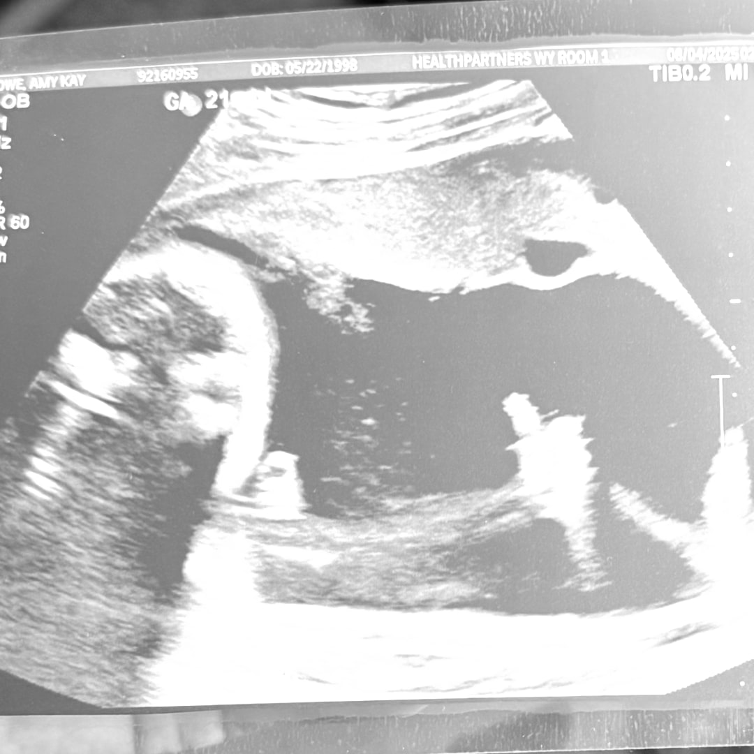 Photo shared by Amy for their Babylist baby registry.
