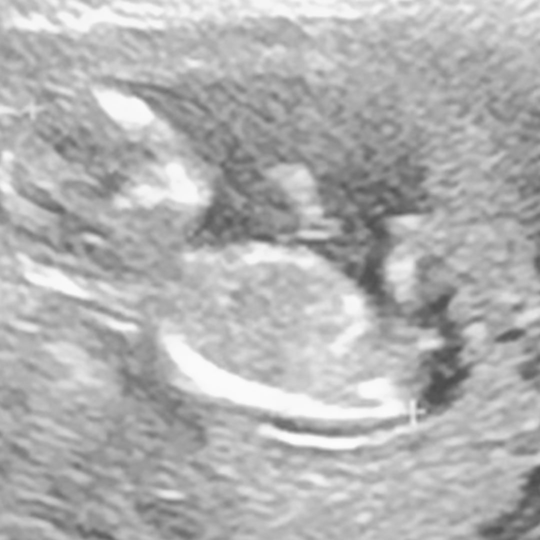 Photo shared by Carissa for their Babylist baby registry.