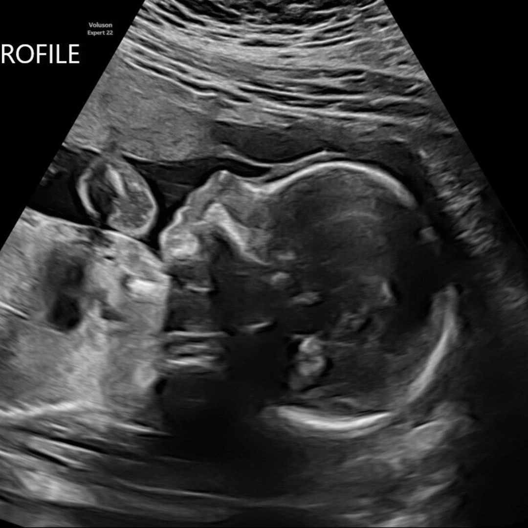 Photo shared by Bailey for their Babylist baby registry.