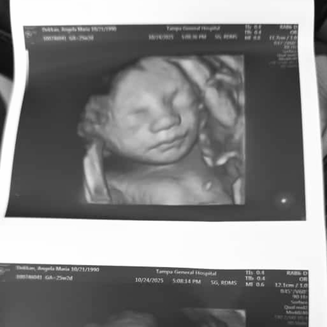 Photo shared by Angela for their Babylist baby registry.