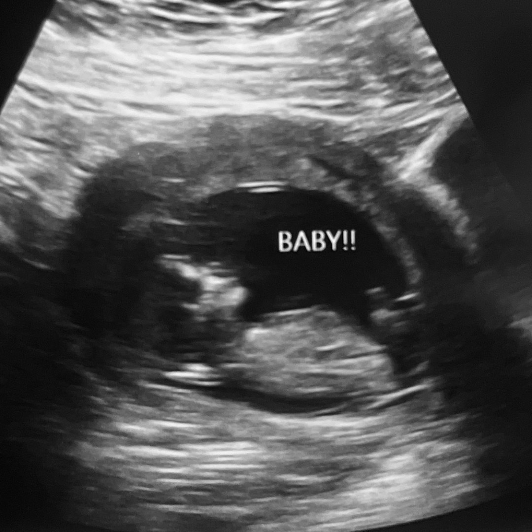 Photo shared by Ariel for their Babylist baby registry.