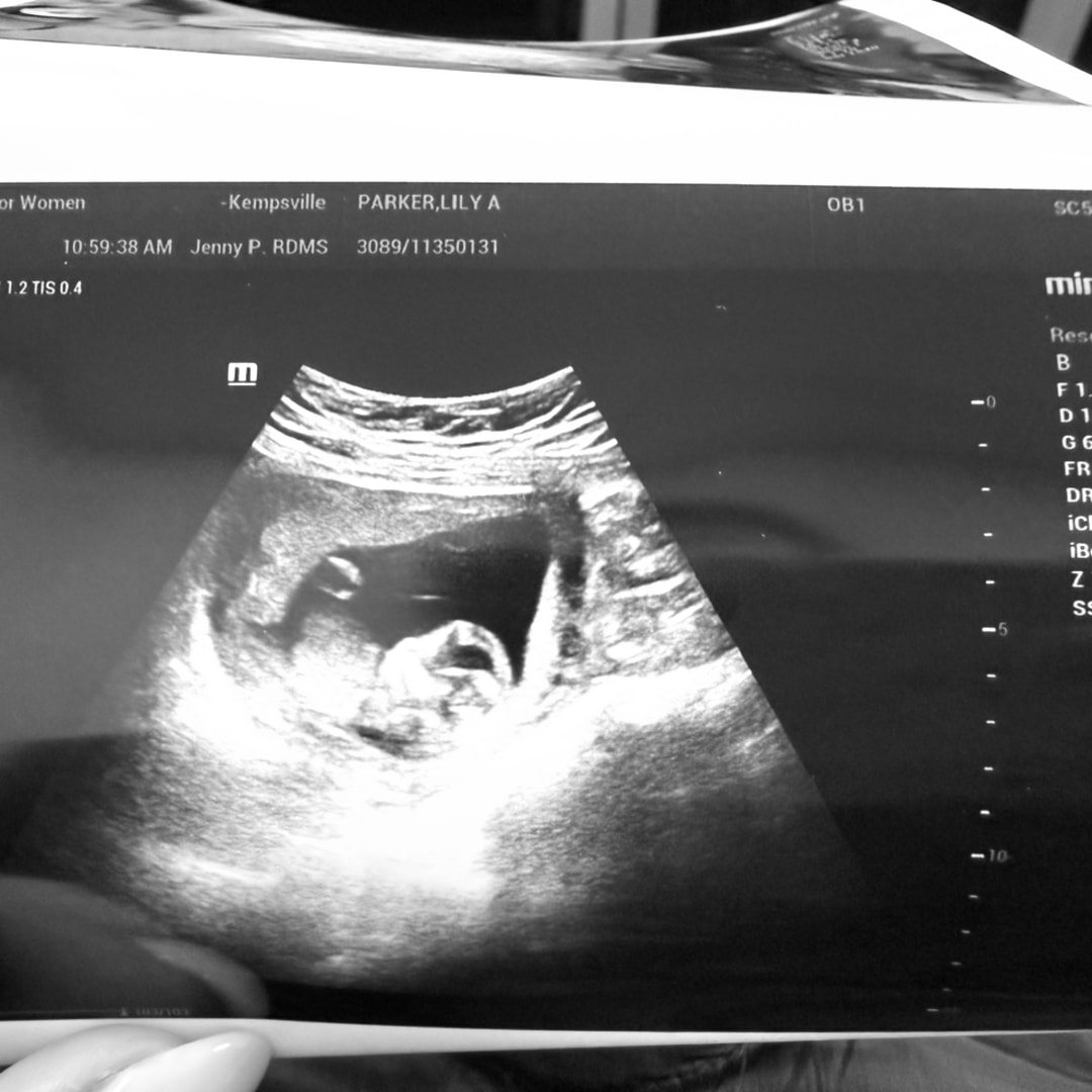Photo shared by Lily for their Babylist baby registry.