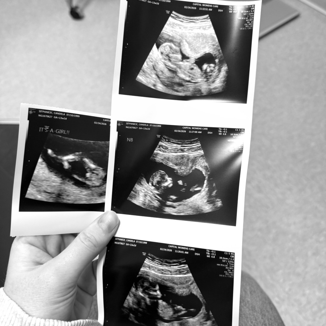 Photo shared by Candela for their Babylist baby registry.