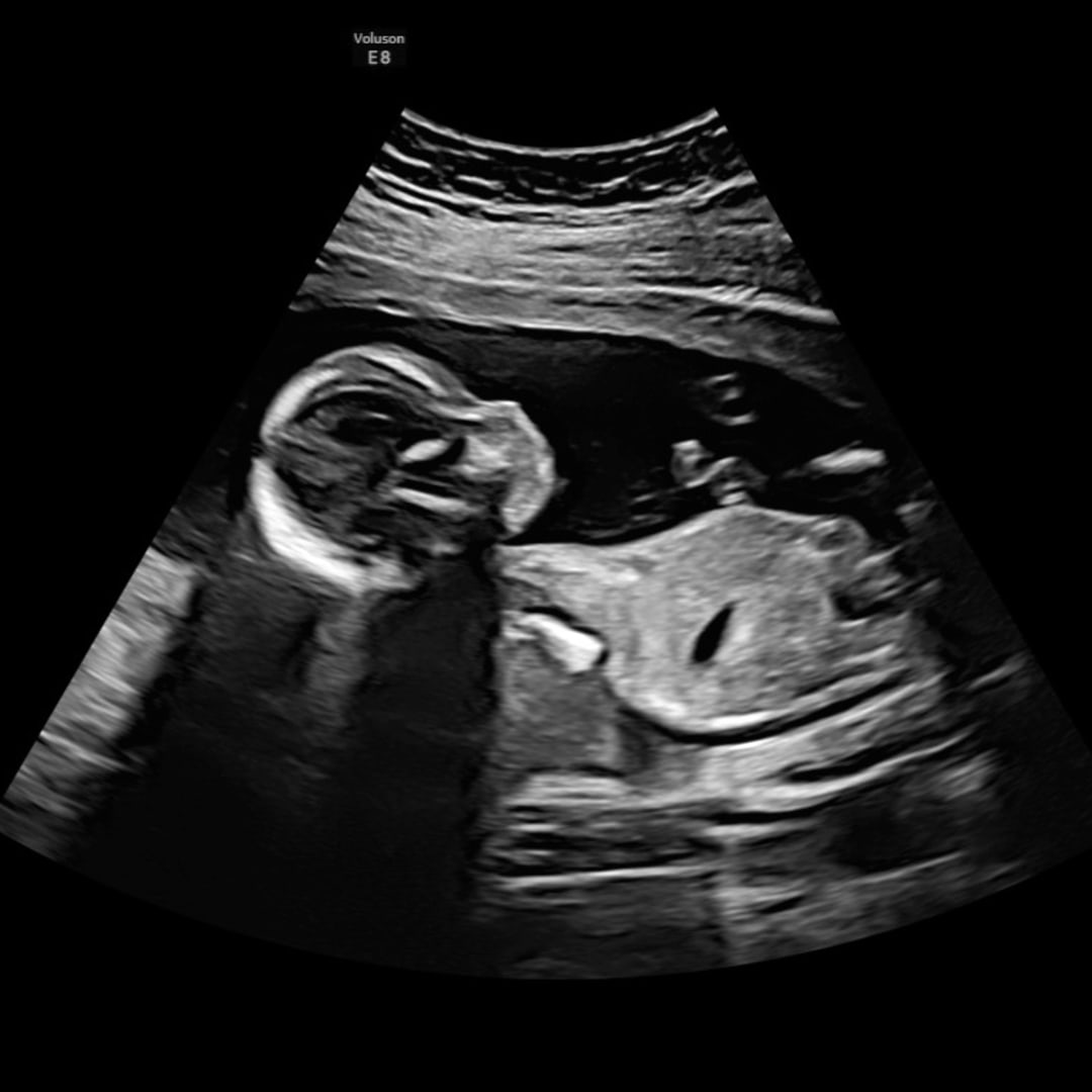 Photo shared by Meg for their Babylist baby registry.